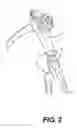 Fig. 03 - Medical device stand