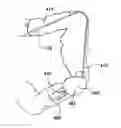 Fig. 01 - BALLOON GUIDED ENDOSCOPY