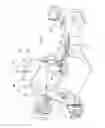 Fig. 02 - BALLOON GUIDED ENDOSCOPY