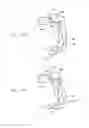Fig. 28 - BALLOON GUIDED ENDOSCOPY
