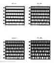 Fig. 22 - COMPUTERIZED REFRACTION AND ASTIGMATISM DETERMINATION