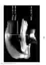 Fig. 09 - Optical imaging and measurement systems and methods for cataract surgery and treatment planning