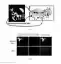 Fig. 06 - Intra-operative molecular imaging