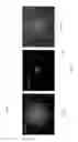 Fig. 06 - SYSTEM AND METHOD FOR IMPROVED LIGHT DELIVERY TO AND FROM SUBJECTS