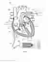 Fig. 09 - SYSTEM AND APPARATUS COMPRISING A MULTI-SENSOR CATHETER FOR RIGHT HEART AND PULMONARY ARTERY CATHETERIZATION