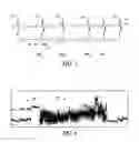 Fig. 07 - Method to trigger an atrial fibrillation electrogram in an implantable device that detects R-waves