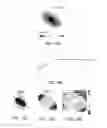 Fig. 11 - SYSTEMS AND METHODS FOR CHARACTERIZING THE CONDUCTIVE PROPERTIES OF THE HEART