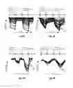 Fig. 08 - Dynamic optical tomographic imaging devices methods and systems