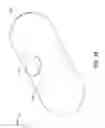 Fig. 11 - Gastrointestinal sensor implantation system