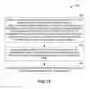 Fig. 16 - Gastrointestinal sensor implantation system