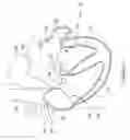 Fig. 02 - Left atrial appendage implant