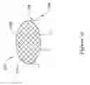 Fig. 14 - Left atrial appendage implant