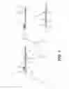 Fig. 02 - System and method for all-inside suture fixation for implant attachment and soft tissue repair