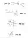 Fig. 08 - System and method for all-inside suture fixation for implant attachment and soft tissue repair