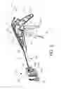 Fig. 03 - Surgical instrument comprising a system for bypassing an operational step of the surgical instrument