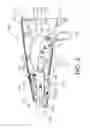 Fig. 07 - Surgical instrument comprising a system for bypassing an operational step of the surgical instrument