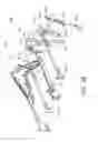 Fig. 35 - Surgical instrument comprising a system for bypassing an operational step of the surgical instrument