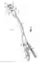 Fig. 02 - Surgical instrument and method for performing a resection