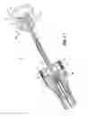 Fig. 06 - Surgical instrument and method for performing a resection