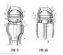 Fig. 09 - Surgical instrument and method for performing a resection