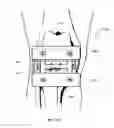 Fig. 09 - Combined Measured Resection Methods and Instruments for Knee Arthroplasty