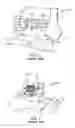 Fig. 02 - Surgical instrumentation and methods of use for implanting a prosthesis
