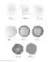 Fig. 05 - METHODS OF TREATING DEGENERATIVE BONE CONDITIONS