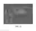 Fig. 14 - METHODS OF TREATING DEGENERATIVE BONE CONDITIONS
