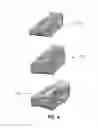 Fig. 07 - Skin-Referencing Surgical Guides