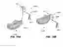 Fig. 08 - Skin-Referencing Surgical Guides