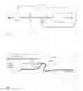 Fig. 03 - INTRAVASCULAR TISSUE DISRUPTION
