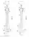 Fig. 07 - Methods and devices for removing obstructing material from the human body