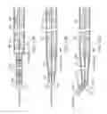 Fig. 11 - Methods and devices for removing obstructing material from the human body