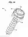Fig. 02 - Low profile spinal tethering devices