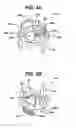 Fig. 04 - Low profile spinal tethering devices