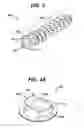 Fig. 05 - Low profile spinal tethering devices