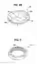 Fig. 06 - Low profile spinal tethering devices