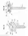 Fig. 08 - Low profile spinal tethering devices