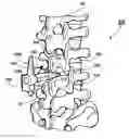 Fig. 01 - Adjustable spine distraction implant