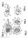 Fig. 03 - Adjustable spine distraction implant