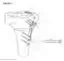 Fig. 03 - Fixing tool for open-wedge high tibial osteotomy