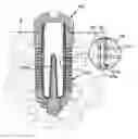 Fig. 01 - Drug delivery implant implanted into bone