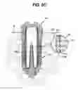 Fig. 08 - Drug delivery implant implanted into bone