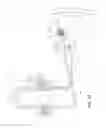 Fig. 20 - Medical systems and methods