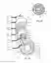 Fig. 02 - Methods and systems for blocking neural activity in an organ of a subject, preferably in the small intestine or the duodenum