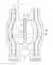 Fig. 11 - Methods and systems for blocking neural activity in an organ of a subject, preferably in the small intestine or the duodenum