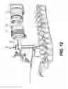 Fig. 13 - Robot arm and methods of use