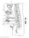 Fig. 15 - Robot arm and methods of use