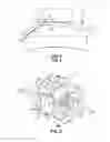 Fig. 02 - ORTHODONTIC BRACKET AND METHOD OF CORRECTING MALPOSITIONED TEETH