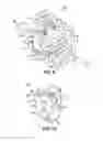 Fig. 06 - ORTHODONTIC BRACKET AND METHOD OF CORRECTING MALPOSITIONED TEETH